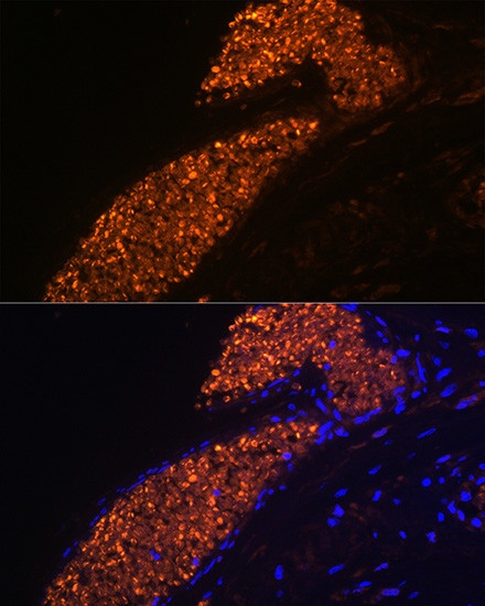 Hemoglobin gamma-1 Antibody in Immunohistochemistry (Paraffin) (IHC (P))