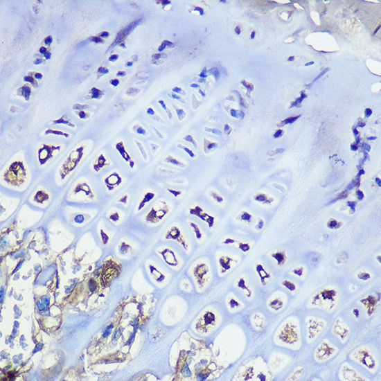 Aggrecan Antibody in Immunohistochemistry (Paraffin) (IHC (P))