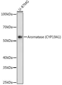 Aromatase Antibody in Western Blot (WB)