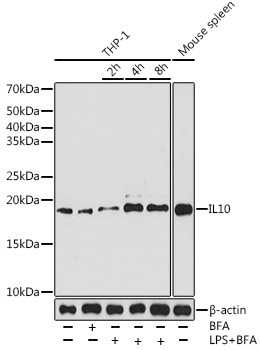 IL-10 Recombinant Rabbit Monoclonal Antibody (6U0G7)