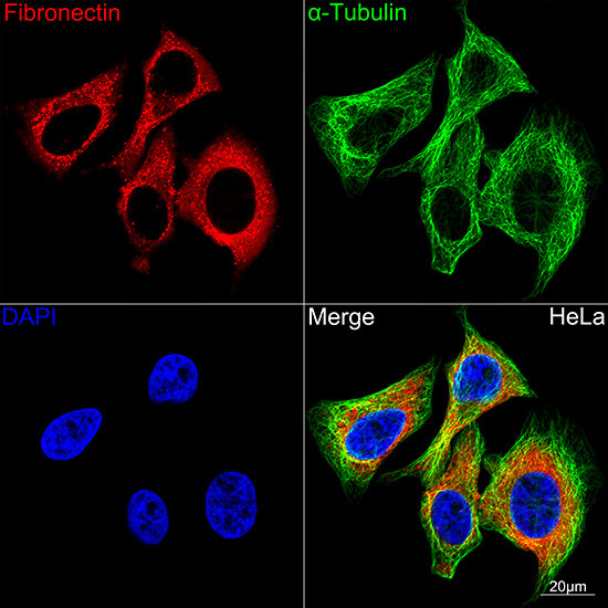 Fibronectin Antibody in Immunocytochemistry (ICC/IF)