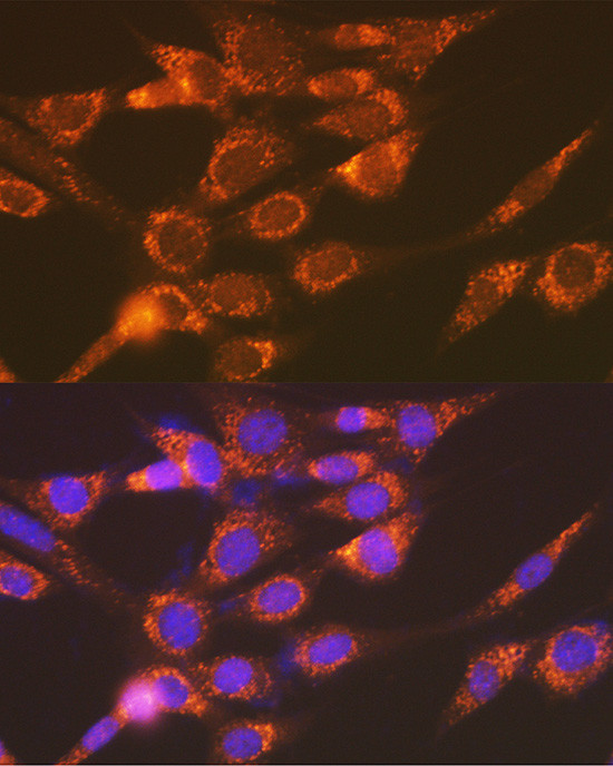 Versican Antibody in Immunocytochemistry (ICC/IF)