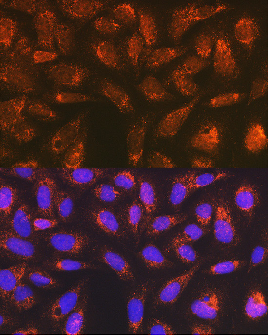 Versican Antibody in Immunocytochemistry (ICC/IF)