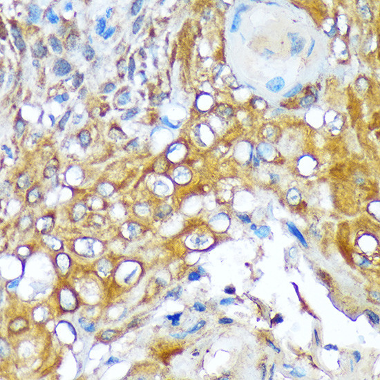 Versican Antibody in Immunohistochemistry (Paraffin) (IHC (P))