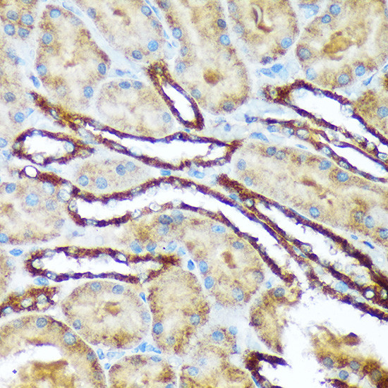 Versican Antibody in Immunohistochemistry (Paraffin) (IHC (P))