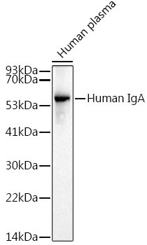 Human IgA Antibody in Western Blot (WB)