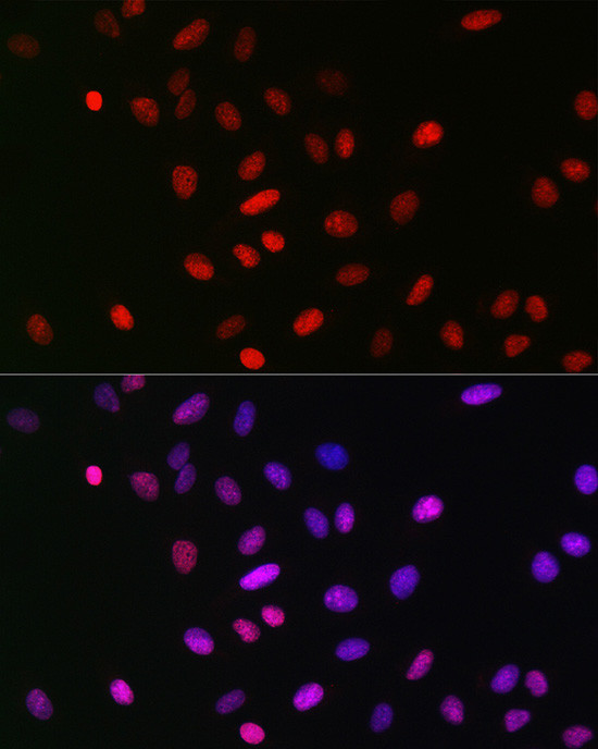 H3K18me1 Antibody in Immunocytochemistry (ICC/IF)