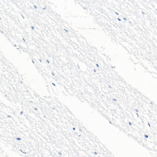 CD79b Antibody in Immunohistochemistry (Paraffin) (IHC (P))