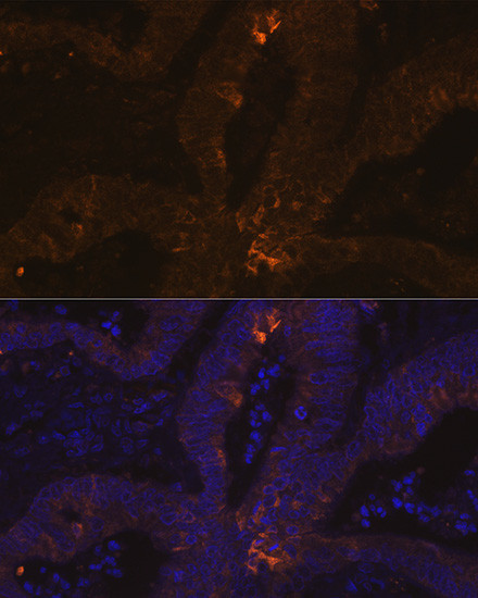 TFF1 Antibody in Immunohistochemistry (Paraffin) (IHC (P))