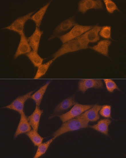 Cyclin B2 Antibody in Immunocytochemistry (ICC/IF)