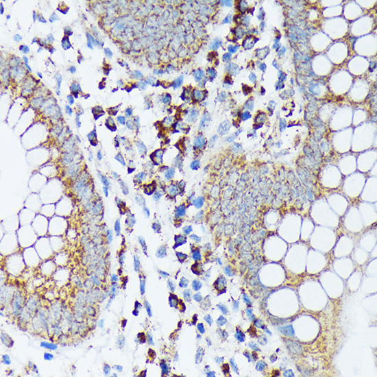 SPRY2 Antibody in Immunohistochemistry (Paraffin) (IHC (P))