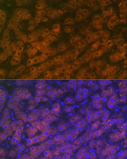 RBP4 Antibody in Immunohistochemistry (Paraffin) (IHC (P))