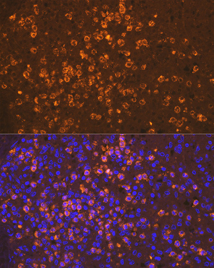 Neutrophil elastase Antibody in Immunohistochemistry (Paraffin) (IHC (P))