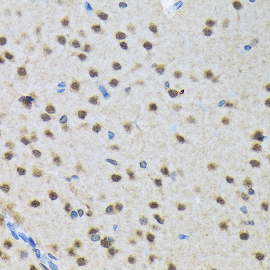 SMN1 Antibody in Immunohistochemistry (Paraffin) (IHC (P))