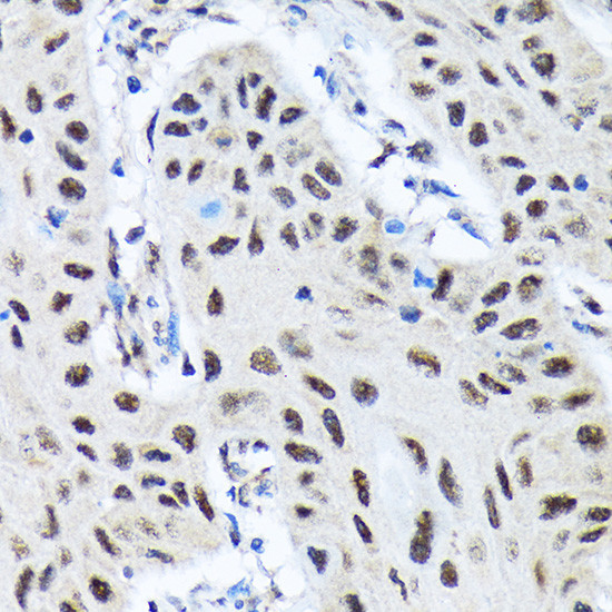 SMN1 Antibody in Immunohistochemistry (Paraffin) (IHC (P))