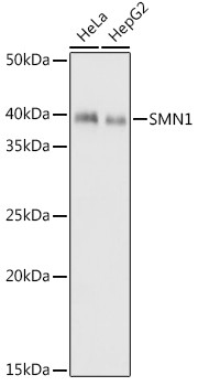 SMN1 Antibody in Western Blot (WB)