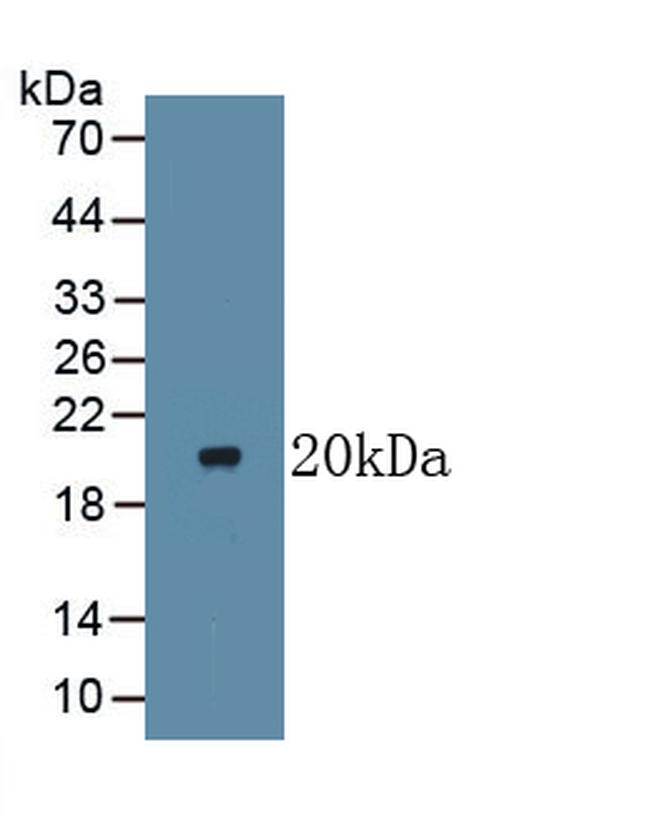 LTBR Antibody in Western Blot (WB)