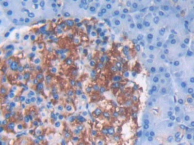 IFNA5 Antibody in Immunohistochemistry (Paraffin) (IHC (P))