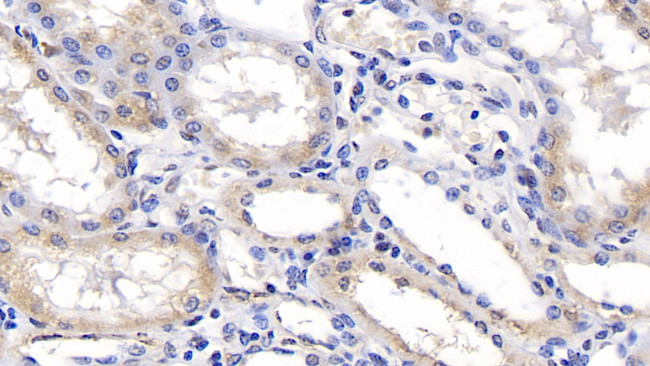 ERLIN2 Antibody in Immunohistochemistry (Paraffin) (IHC (P))