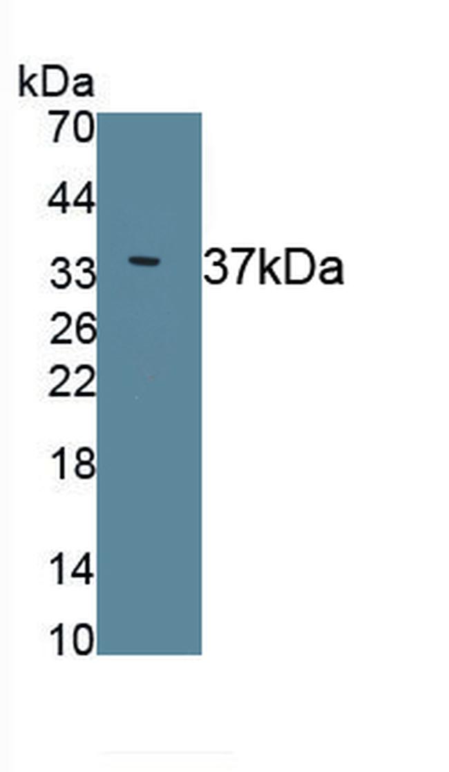 ERLIN2 Antibody in Western Blot (WB)