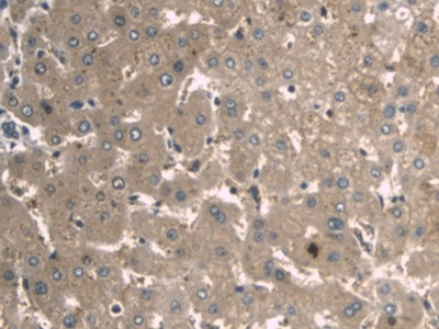 A1BG Antibody in Immunohistochemistry (Paraffin) (IHC (P))