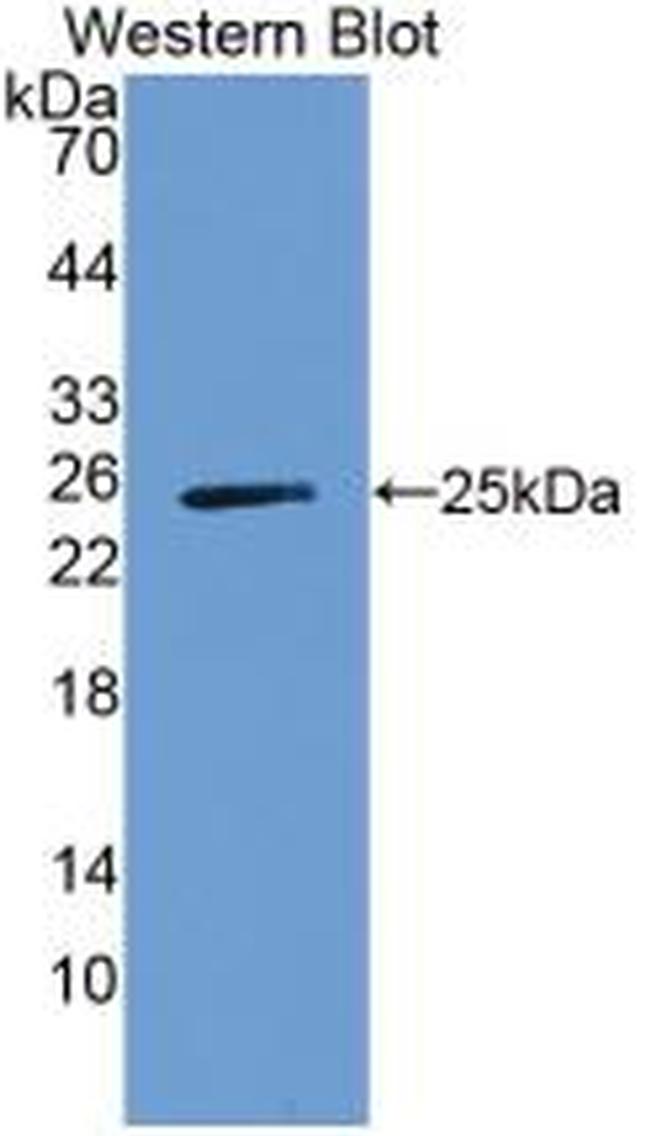 A1BG Antibody in Western Blot (WB)