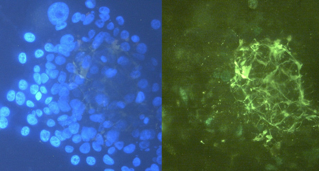 Tenascin C Antibody in Immunocytochemistry (ICC/IF)