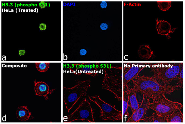 Phospho-Histone H3.3 (Ser31) Antibody in Immunocytochemistry (ICC/IF)