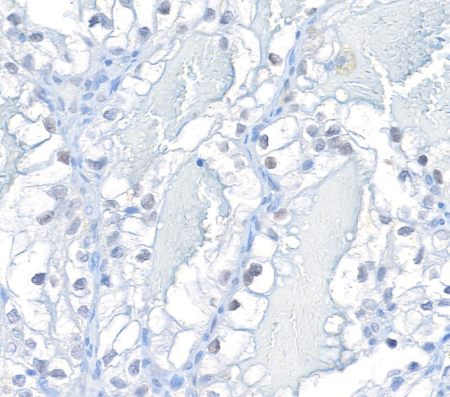 HIF-2 alpha Antibody in Immunohistochemistry (Paraffin) (IHC (P))