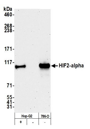 HIF-2 alpha Antibody in Western Blot (WB)