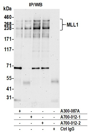 HRX Antibody in Immunoprecipitation (IP)