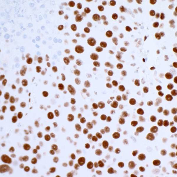 53BP1 Antibody in Immunohistochemistry (Paraffin) (IHC (P))