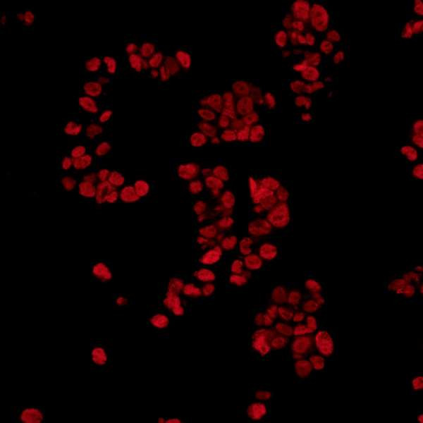 FUS Antibody in Immunocytochemistry (ICC/IF)