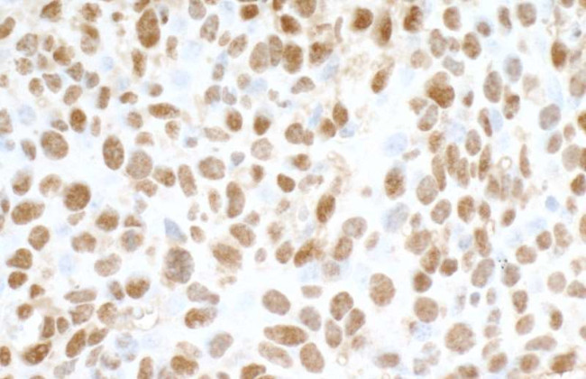 FUS Antibody in Immunohistochemistry (Paraffin) (IHC (P))