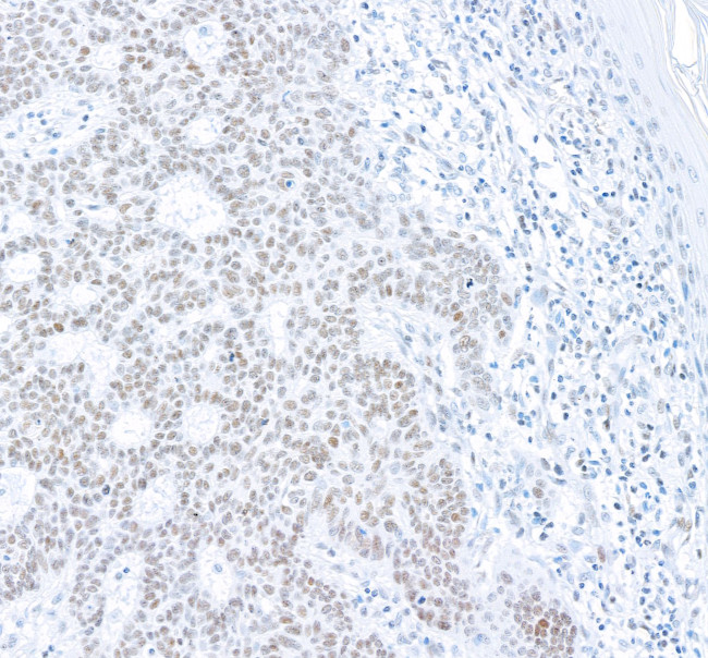 Phospho-gamma-H2AX (Ser139) Antibody in Immunohistochemistry (Paraffin) (IHC (P))