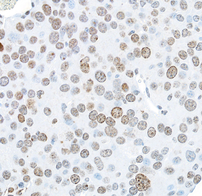 Phospho-gamma-H2AX (Ser139) Antibody in Immunohistochemistry (Paraffin) (IHC (P))