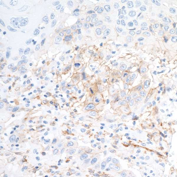 CD73 Antibody in Immunohistochemistry (Paraffin) (IHC (P))