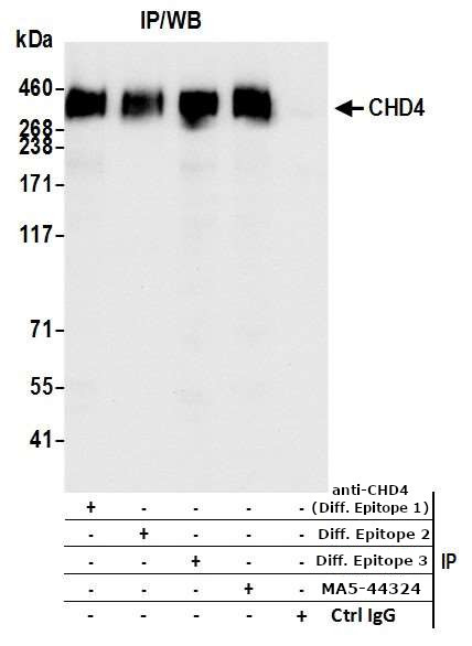 CHD4 Antibody in Immunoprecipitation (IP)