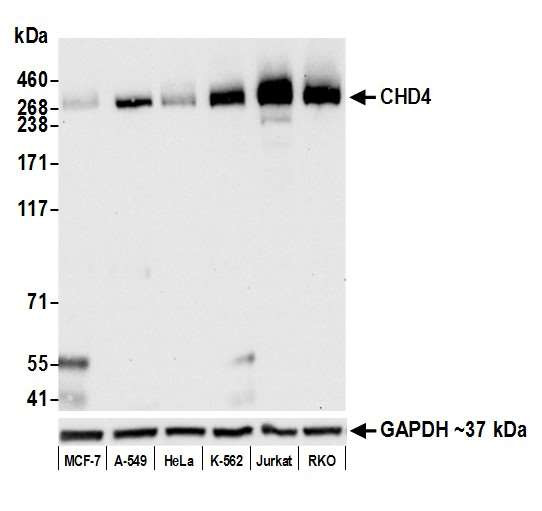 CHD4 Antibody in Western Blot (WB)