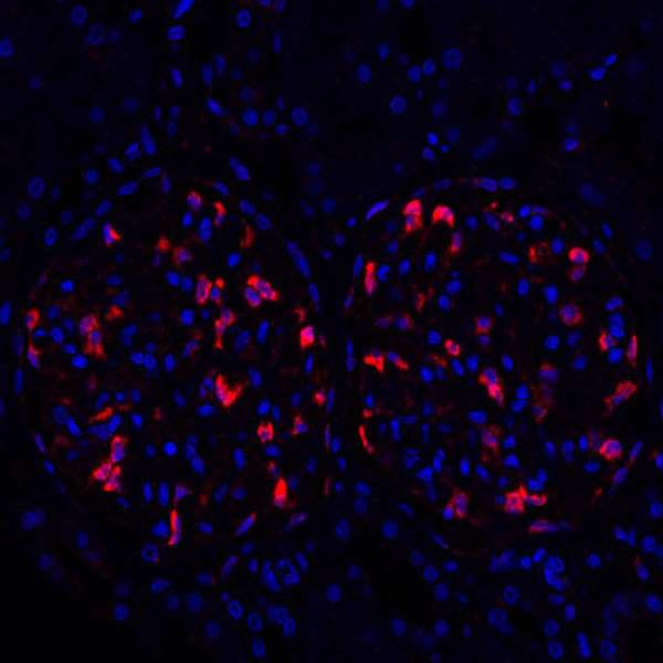 ZO-1 Antibody in Immunohistochemistry (Paraffin) (IHC (P))