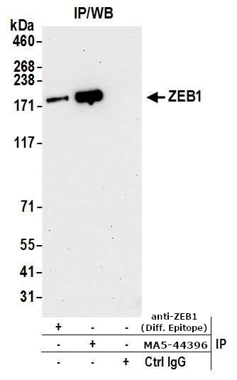 ZEB1 Antibody in Immunoprecipitation (IP)