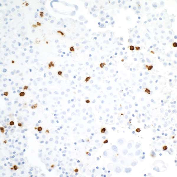 CEACAM8 Antibody in Immunohistochemistry (Paraffin) (IHC (P))