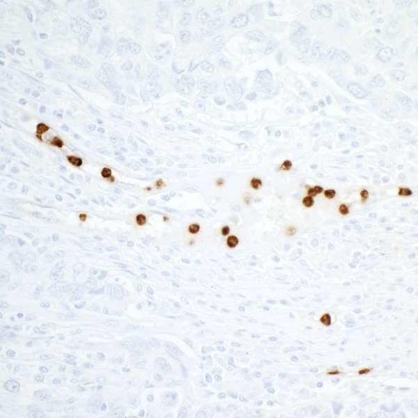 CEACAM8 Antibody in Immunohistochemistry (Paraffin) (IHC (P))