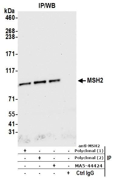 MSH2 Antibody in Immunoprecipitation (IP)