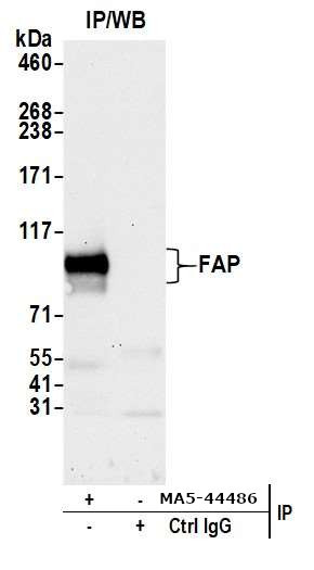 FAP Antibody in Immunoprecipitation (IP)