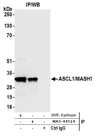 MASH1 Antibody in Immunoprecipitation (IP)