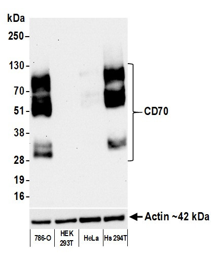 CD70 Antibody in Western Blot (WB)