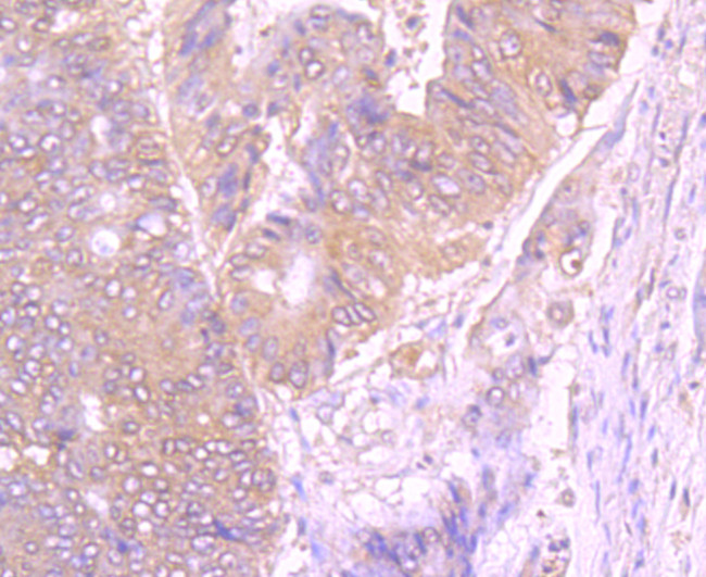 gamma Tubulin Antibody in Immunohistochemistry (Paraffin) (IHC (P))
