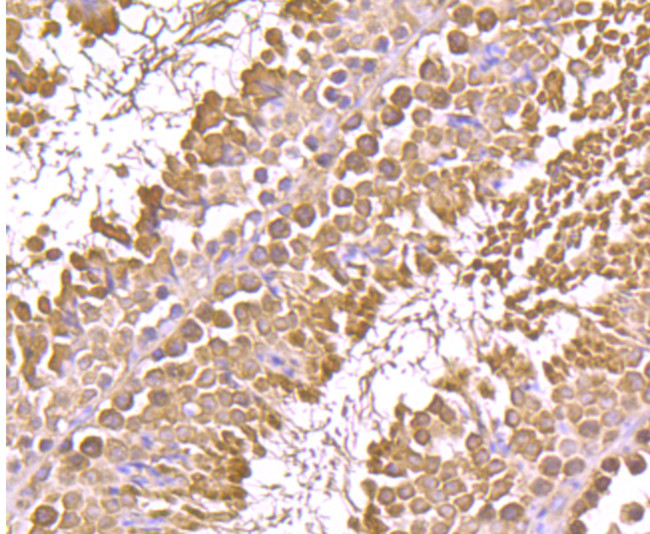 GRP94 Antibody in Immunohistochemistry (Paraffin) (IHC (P))