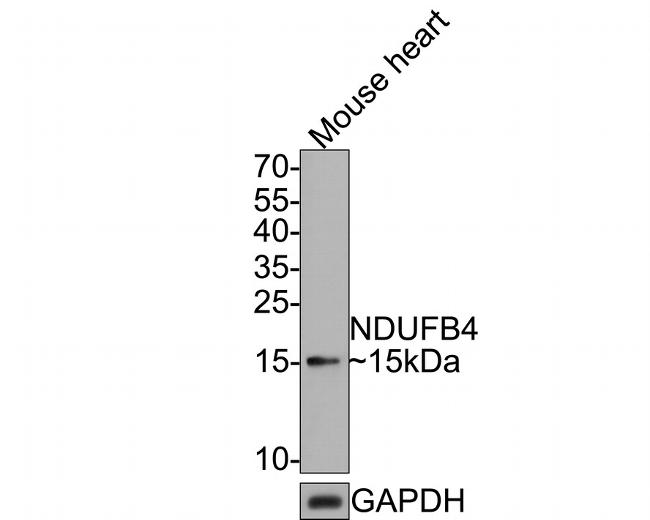 NDUFB4 Antibody in Western Blot (WB)
